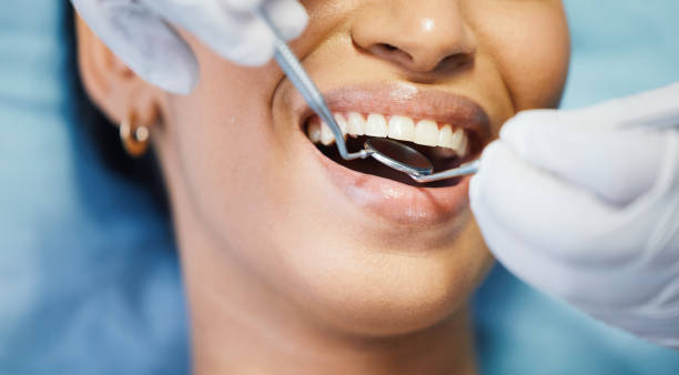 Best Emergency Tooth Extraction in St Regis Park, KY